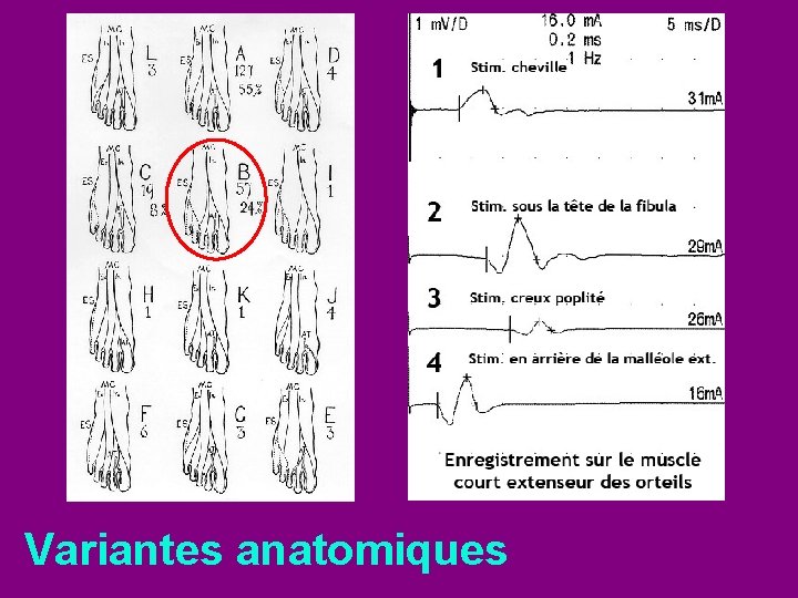 Variantes anatomiques 