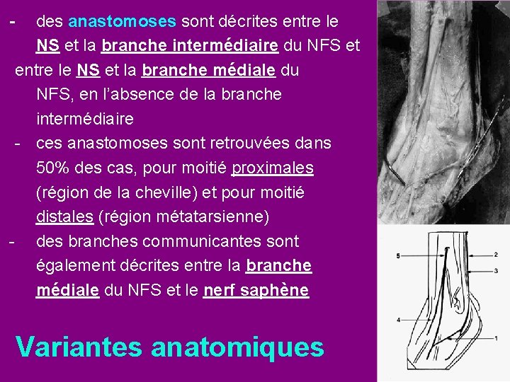 - des anastomoses sont décrites entre le NS et la branche intermédiaire du NFS