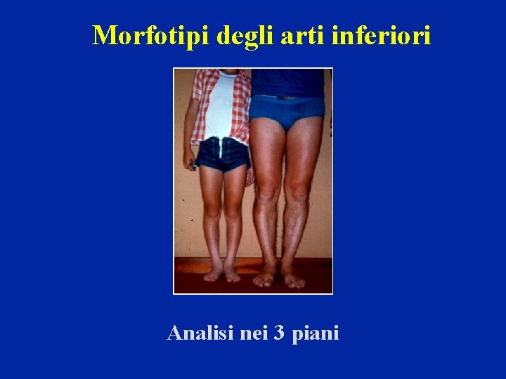 Morfotipi degli arti inferiori Analisi nei 3 piani 