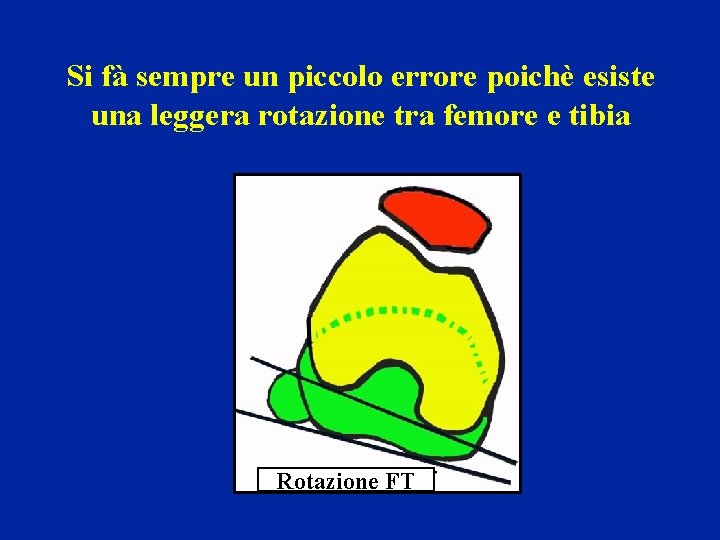 Si fà sempre un piccolo errore poichè esiste una leggera rotazione tra femore e