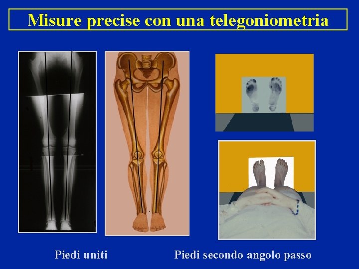 Misure precise con una telegoniometria Piedi uniti Piedi secondo angolo passo 