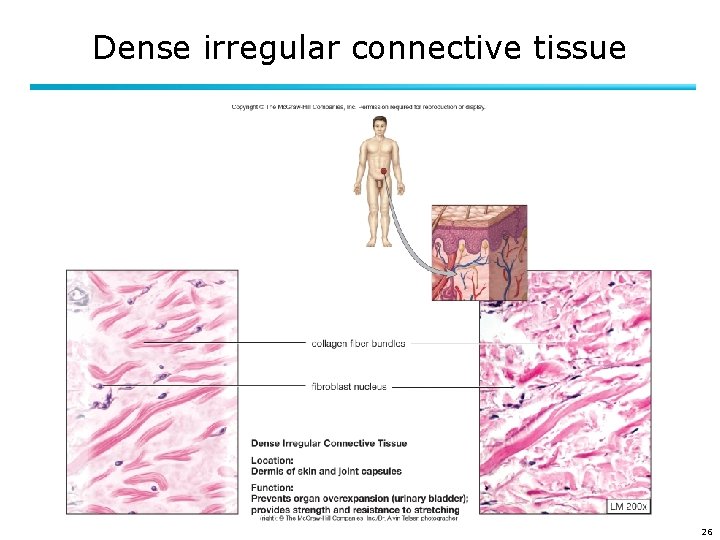 Dense irregular connective tissue 26 