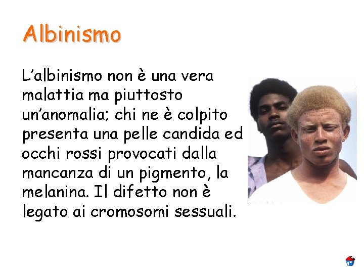 Albinismo L’albinismo non è una vera malattia ma piuttosto un’anomalia; chi ne è colpito