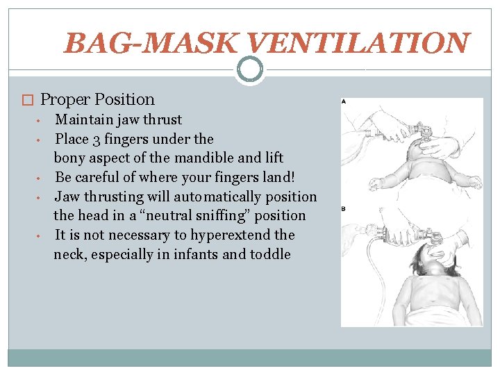 BAG-MASK VENTILATION � Proper Position • Maintain jaw thrust • Place 3 fingers under