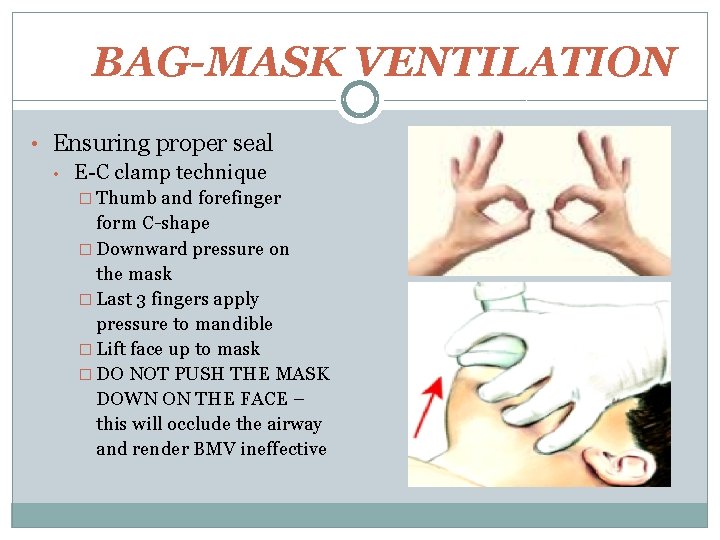 BAG-MASK VENTILATION • Ensuring proper seal • E-C clamp technique � Thumb and forefinger