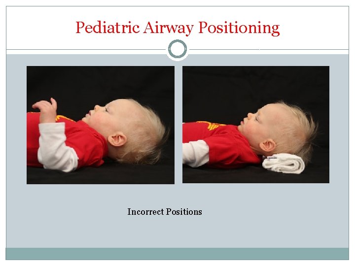 Pediatric Airway Positioning Incorrect Positions 