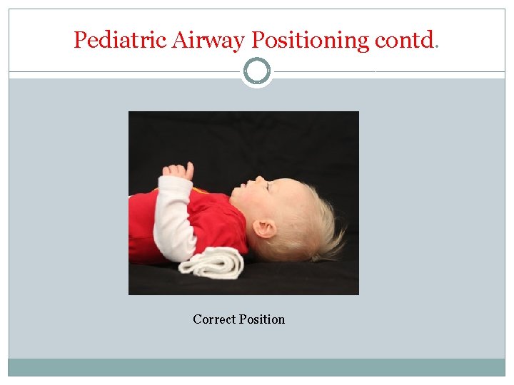 Pediatric Airway Positioning contd. Correct Position 