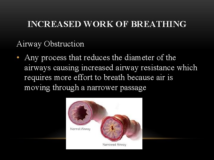 INCREASED WORK OF BREATHING Airway Obstruction • Any process that reduces the diameter of