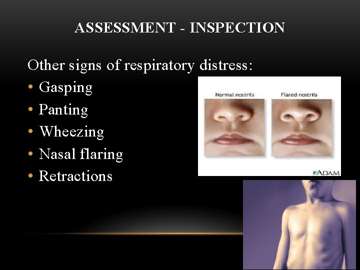 ASSESSMENT - INSPECTION Other signs of respiratory distress: • Gasping • Panting • Wheezing