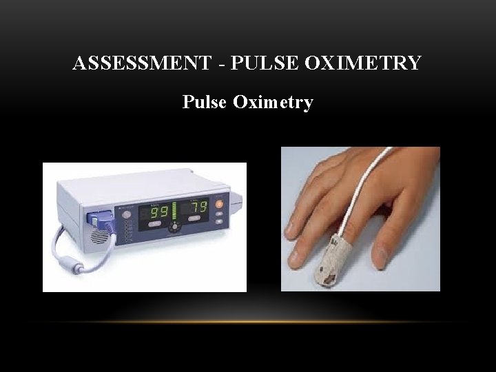 ASSESSMENT - PULSE OXIMETRY Pulse Oximetry 