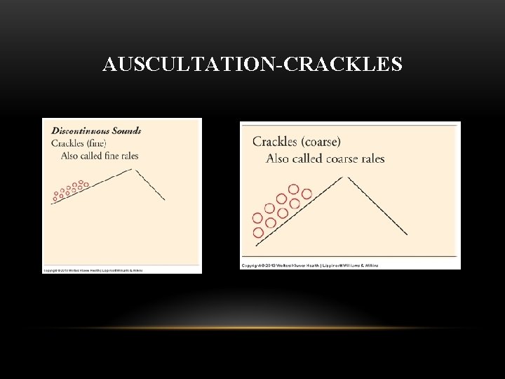 AUSCULTATION-CRACKLES 