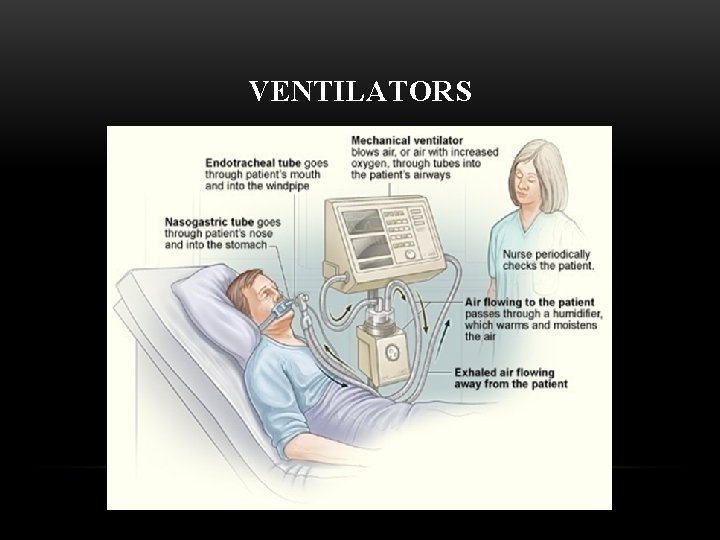 VENTILATORS 