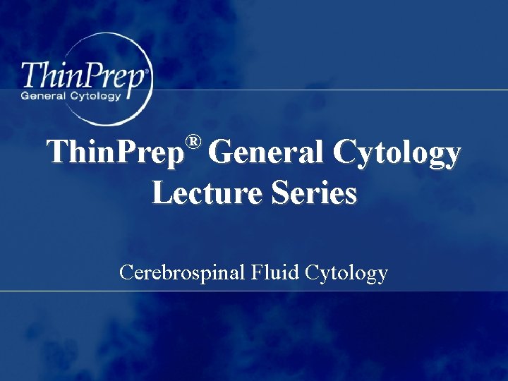 ® Thin. Prep General Cytology Lecture Series Cerebrospinal Fluid Cytology 