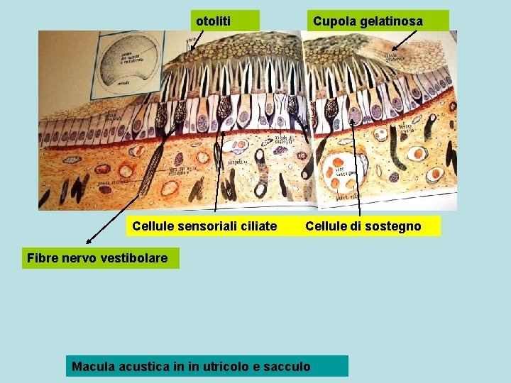 otoliti Cellule sensoriali ciliate Cupola gelatinosa Cellule di sostegno Fibre nervo vestibolare Macula acustica