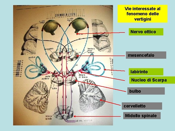 Vie interessate al fenomeno delle vertigini Nervo ottico mesencefalo labirinto Nucleo di Scarpa bulbo