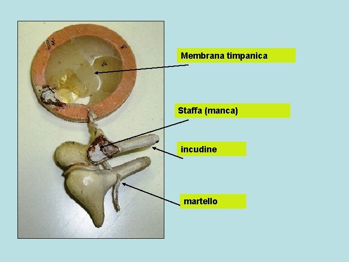 Membrana timpanica Staffa (manca) incudine martello 