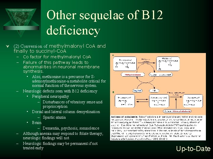 Other sequelae of B 12 deficiency Ú (2) Conversion of methylmalonyl Co. A and