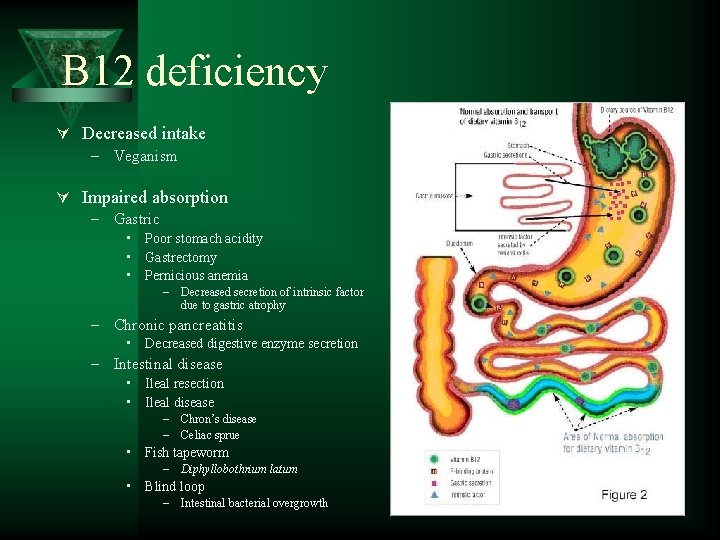 B 12 deficiency Ú Decreased intake – Veganism Ú Impaired absorption – Gastric •