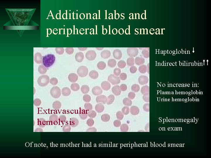 Additional labs and peripheral blood smear Haptoglobin Indirect bilirubin No increase in: Plasma hemoglobin