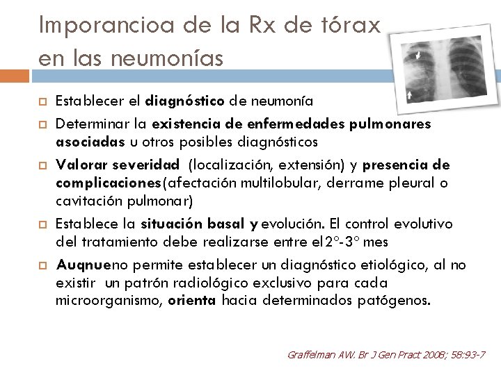 Imporancioa de la Rx de tórax en las neumonías Establecer el diagnóstico de neumonía