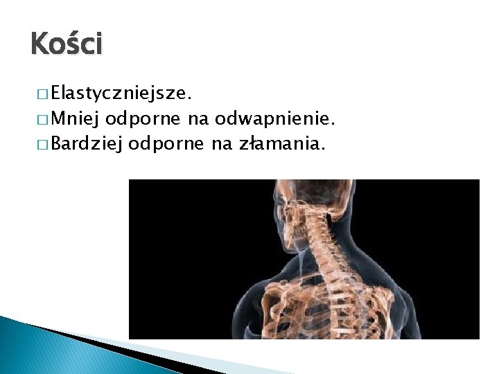 Kości � Elastyczniejsze. � Mniej odporne na odwapnienie. � Bardziej odporne na złamania. 