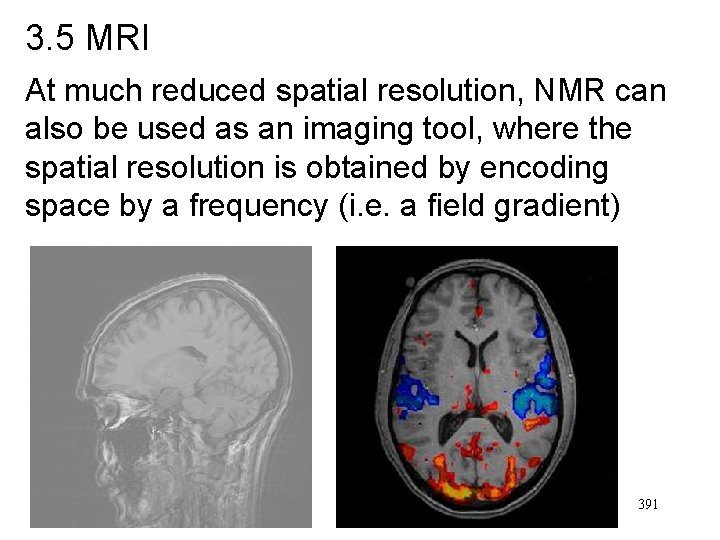 3. 5 MRI At much reduced spatial resolution, NMR can also be used as