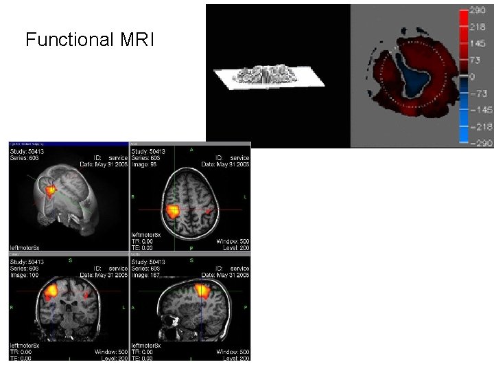 Functional MRI 