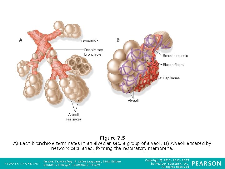 Figure 7. 5 A) Each bronchiole terminates in an alveolar sac, a group of