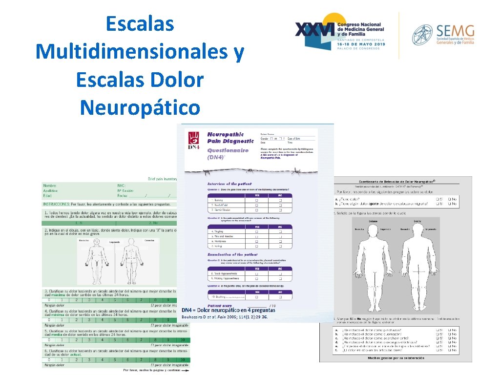 Escalas Multidimensionales y Escalas Dolor Neuropático Escalas Multidimensionales y Escalas Dolor Neuropático