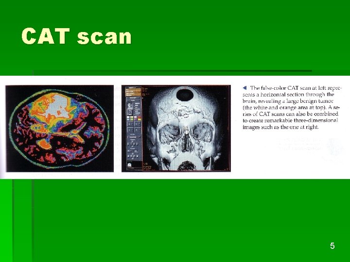 CAT scan 5 