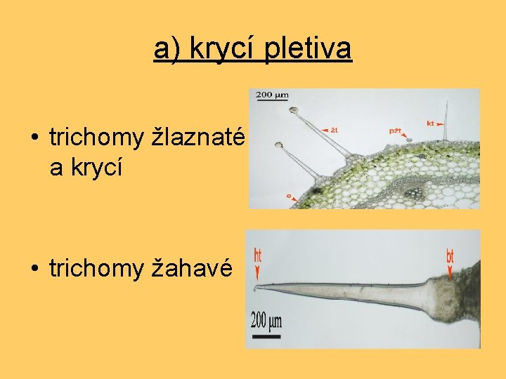 a) krycí pletiva • trichomy žlaznaté a krycí • trichomy žahavé 