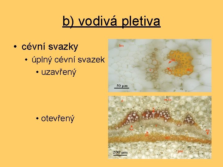 b) vodivá pletiva • cévní svazky • úplný cévní svazek • uzavřený • otevřený