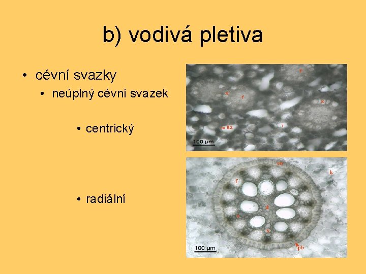 b) vodivá pletiva • cévní svazky • neúplný cévní svazek • centrický • radiální
