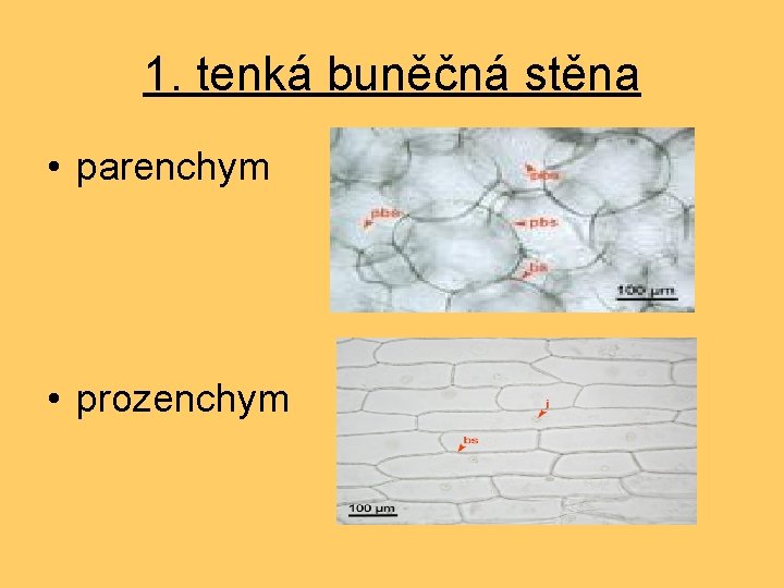 1. tenká buněčná stěna • parenchym • prozenchym 
