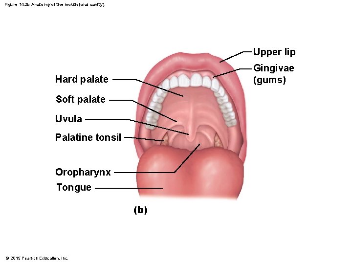 Figure 14. 2 b Anatomy of the mouth (oral cavity). Upper lip Gingivae (gums)