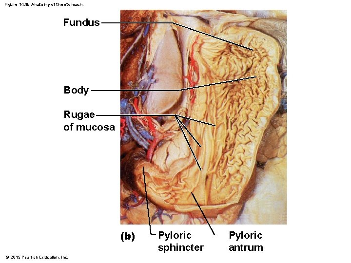 Figure 14. 4 b Anatomy of the stomach. Fundus Body Rugae of mucosa (b)