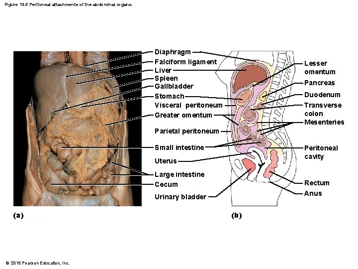 Figure 14. 5 Peritoneal attachments of the abdominal organs. Diaphragm Falciform ligament Liver Spleen