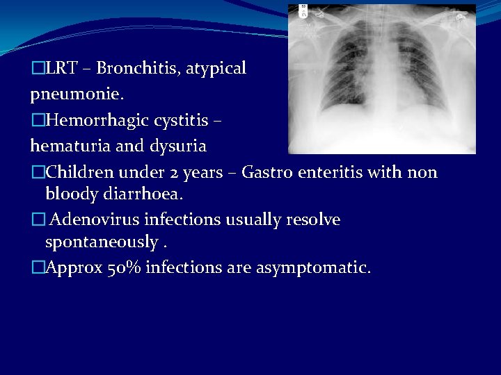 �LRT – Bronchitis, atypical pneumonie. �Hemorrhagic cystitis – hematuria and dysuria �Children under 2
