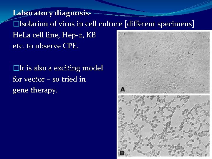 Laboratory diagnosis�Isolation of virus in cell culture [different specimens] He. La cell line, Hep-2,