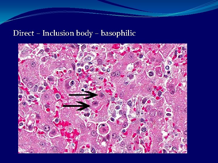 Direct – Inclusion body – basophilic 