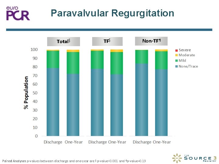 Paravalvular Regurgitation Total§ TF§ Non-TF¶ Severe Paired Analyses p-values between discharge and one-year are