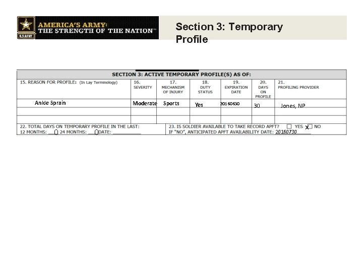 Section 3: Temporary Profile Ankle Sprain 0 Moderate 0 Sports Yes 20160630 30 Jones,