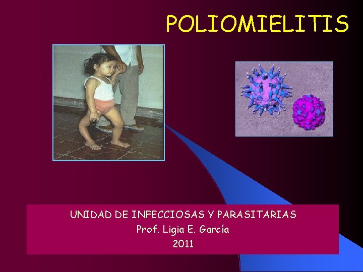 POLIOMIELITIS UNIDAD DE INFECCIOSAS Y PARASITARIAS Prof. Ligia E. García 2011 