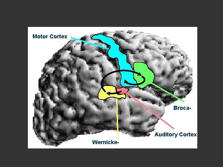 Syndromes of Motor and Sensory Aprosodia Motor Cortex motorischer Kortex Broca. Analogue Analogo n