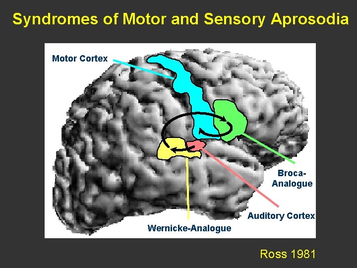 Syndromes of Motor and Sensory Aprosodia Motor Cortex motorischer Kortex Broca. Analogue Analogo n