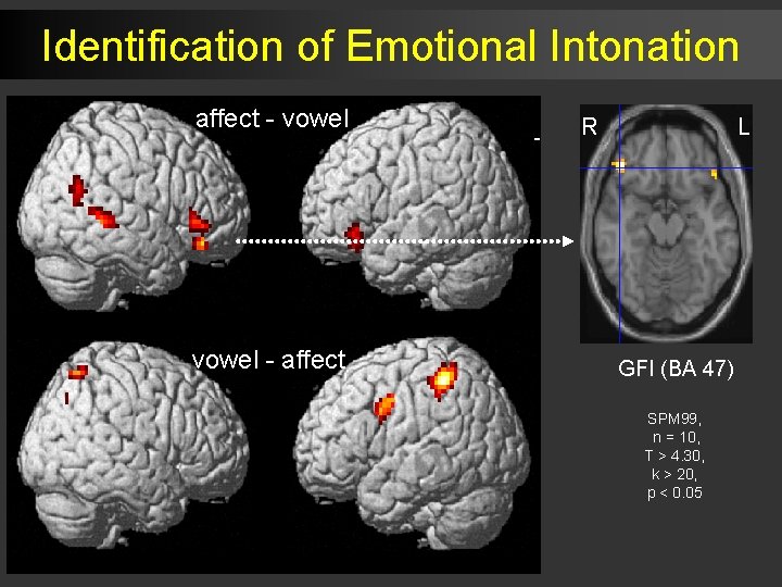 Identification of Emotional Intonation R affect - vowel - affect L R L GFI