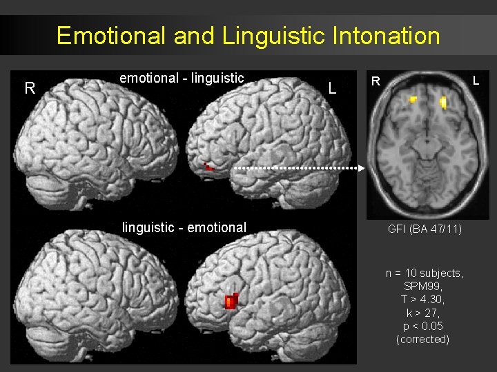 Emotional and Linguistic Intonation R emotional - linguistic - emotional L L R GFI