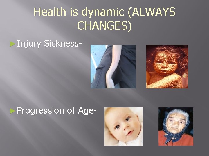 Health is dynamic (ALWAYS CHANGES) ► Injury Sickness- ► Progression of Age- 