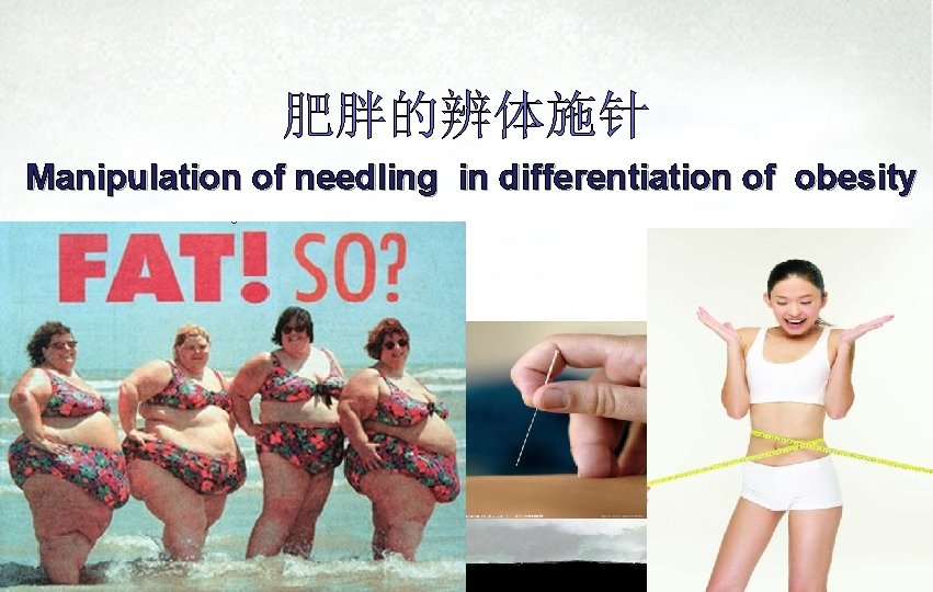 肥胖的辨体施针 Manipulation of needling in differentiation of obesity 