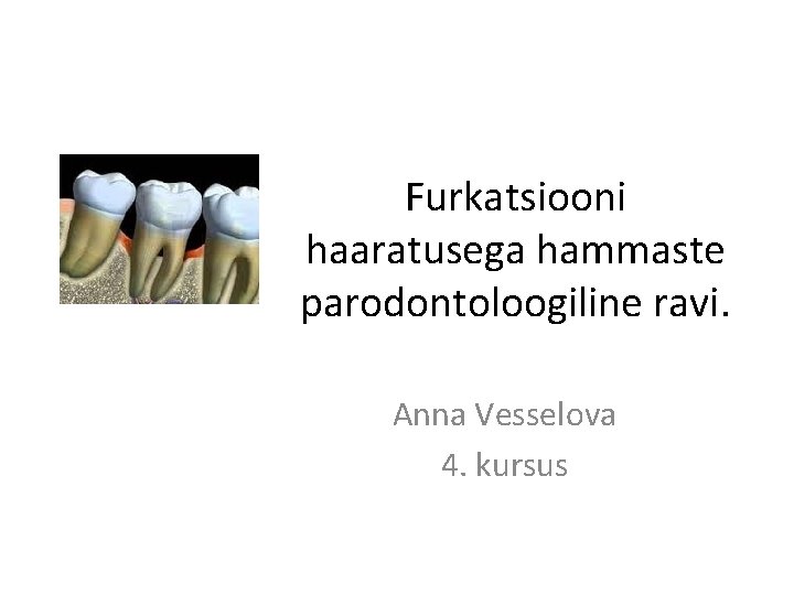 Furkatsiooni haaratusega hammaste parodontoloogiline ravi. Anna Vesselova 4. kursus 